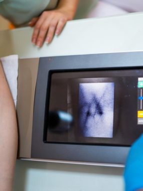 -Smart Wound Imaging (Illuminate, eKare)